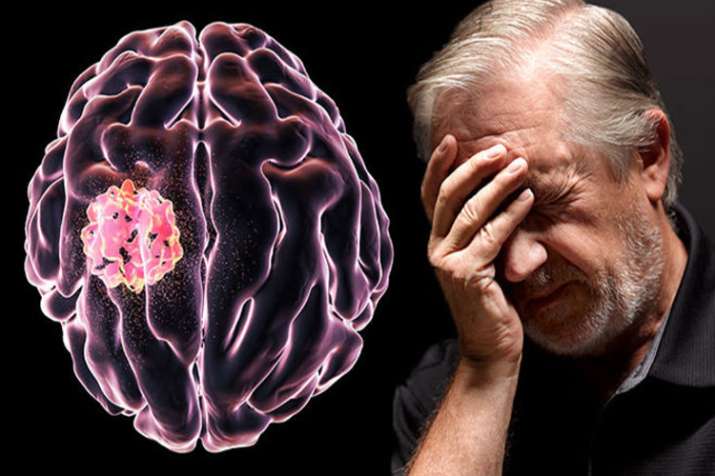 Brain Tumor Brain Tumor- India TV