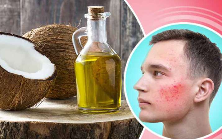 coconut oil coconut oil- India TV