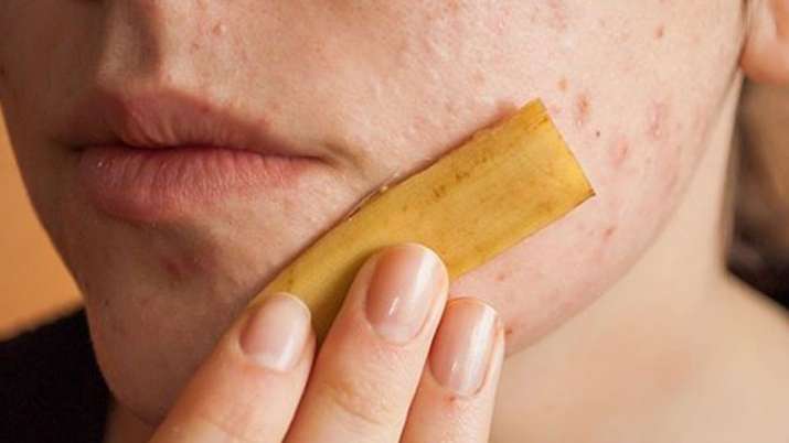 permanent Skin tags moles removal with banan peel and garlic permanent Skin tags moles removal with banan peel and garlic- India TV