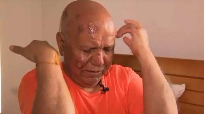 Hindu priest Harish Chander Puri attacked near temple in US | Videograb/PIX 11 news Hindu priest Harish Chander Puri attacked near temple in US | Videograb/PIX 11 news- India TV