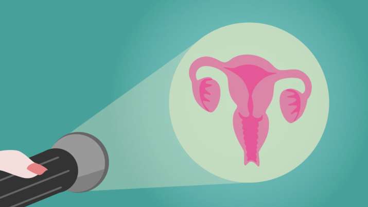 cervical cancer cervical cancer - India TV