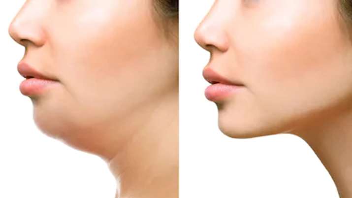 Health Tips Health Tips- India TV