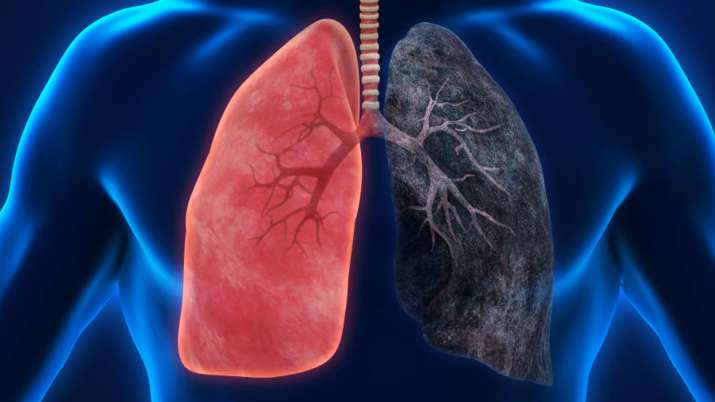 lungs cancer lungs cancer- India TV