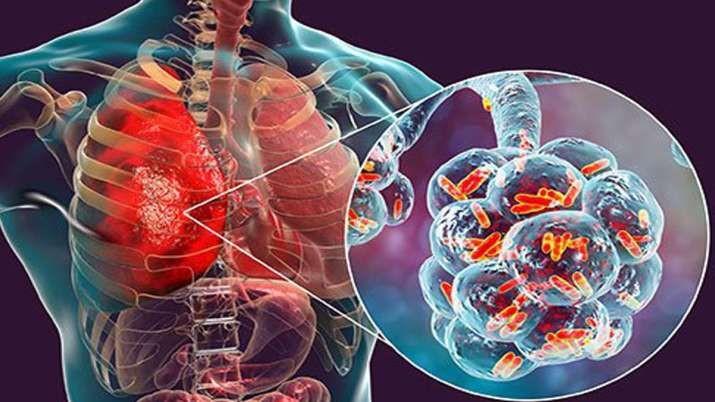 World Pneumonia Day 2019: World Pneumonia Day 2019:- India TV