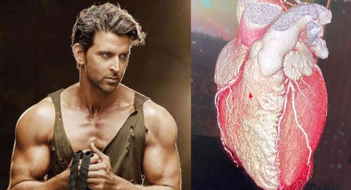 ऋतिक रोशन ने शेयर की... ऋतिक रोशन ने शेयर की...- India TV