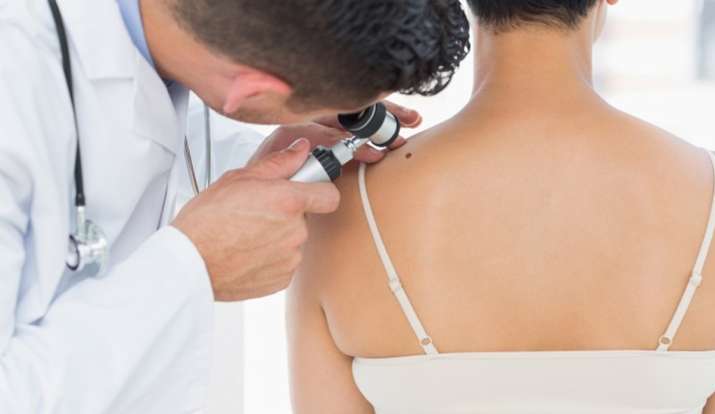 Skin cancer Skin cancer- India TV